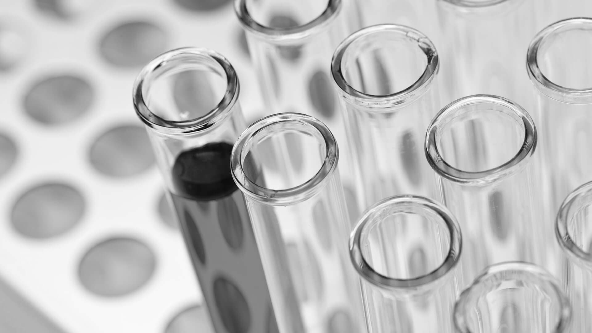 Alles, was Sie über Speichel-Drogentests wissen müssen
