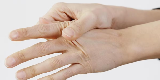 Die Bedeutung der Behandlung des Karpaltunnelsyndroms für Ihre Gesundheit und Beweglichkeit