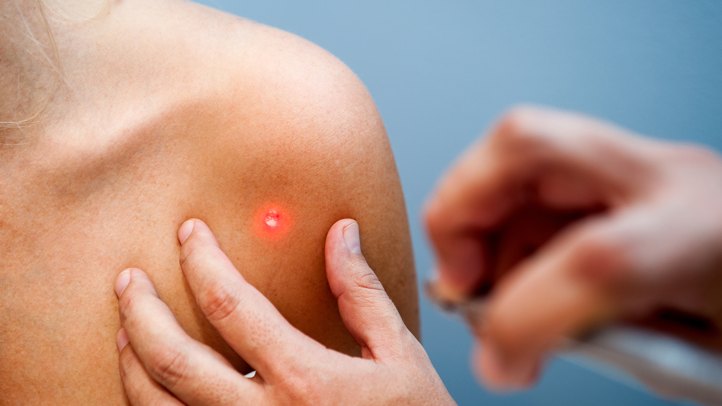 Spezialisierte Dermatologie: Dr. Balázs bietet maßgeschneiderte Pflege und Therapien