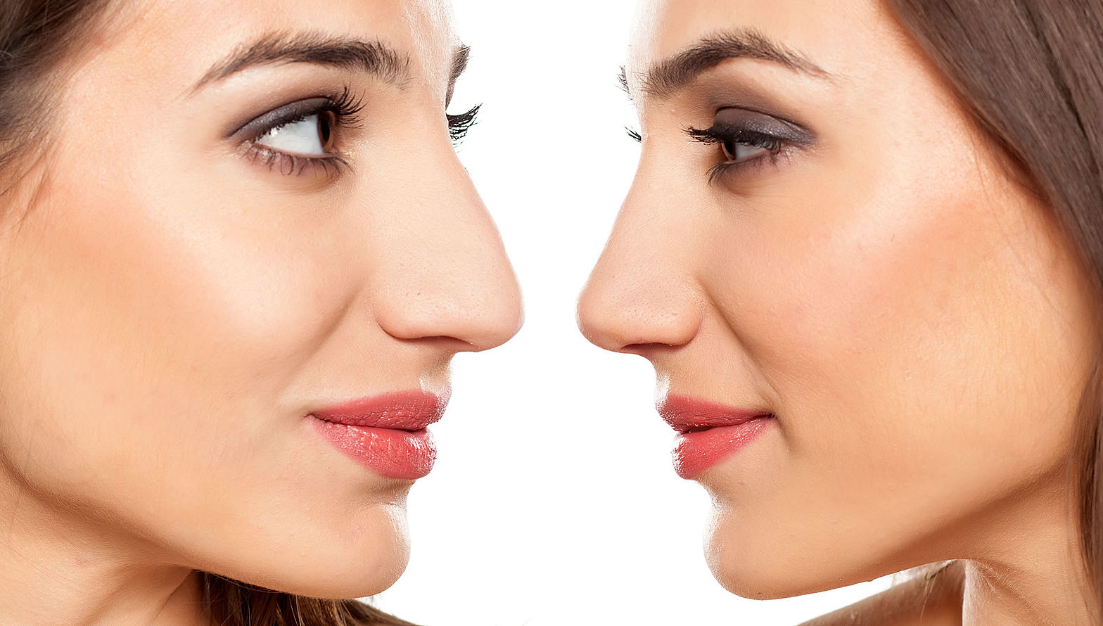 Ethnische Rhinoplastik: Individuelle Rhinoplastik nach Kultur